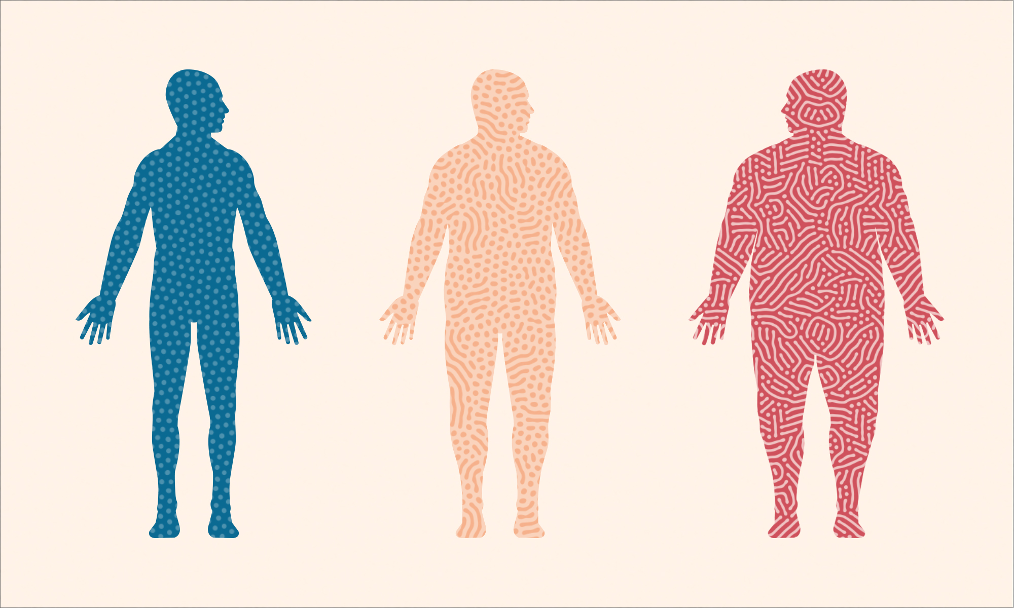 Can Your Biome Make You Fat 