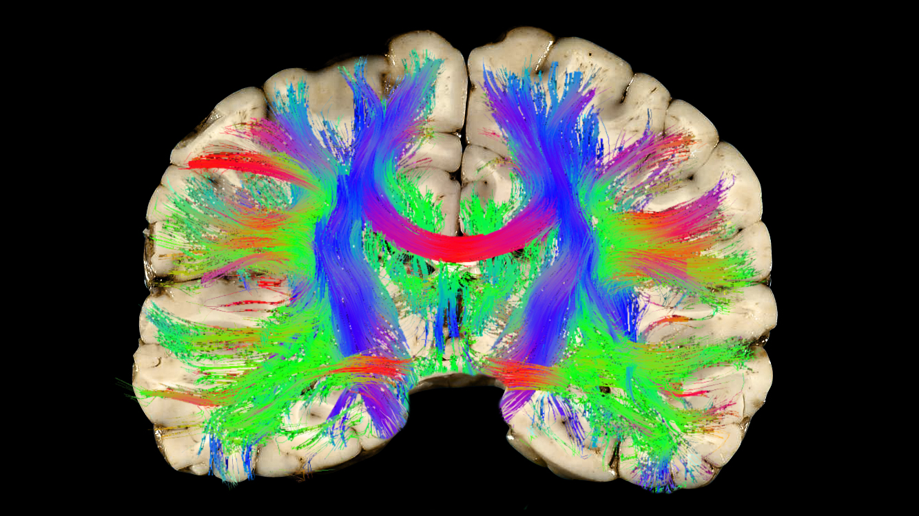 Football helmets don’t protect against concussion — and we’re not sure